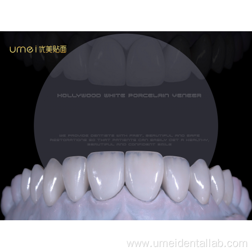 Refractory Veneers